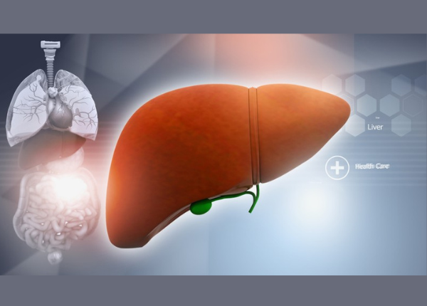 Gan nhiễm mỡ là bệnh gì? Nguyên nhân và dấu hiệu nhận biết 