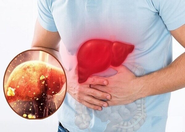 Tăng men gan như nào? Dấu hiệu tăng men gan nên biết? 